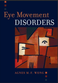 Image of Eye movement disorders