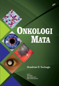 Image of Onkologi mata