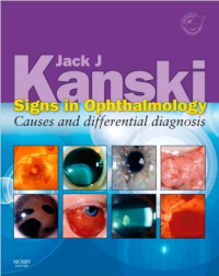 Image of Signs in ophthalmology : causes and differential diagnosis