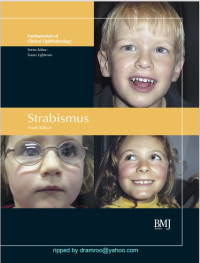 Image of Strabismus : fundamentals of clinical opthalmology